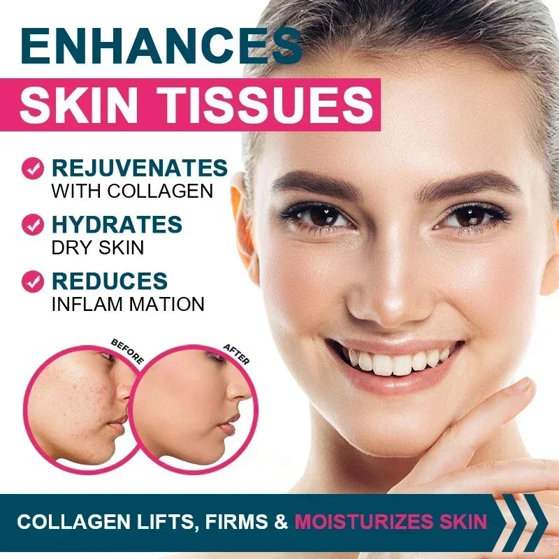 Multiple Collagen Complex – 5 Types