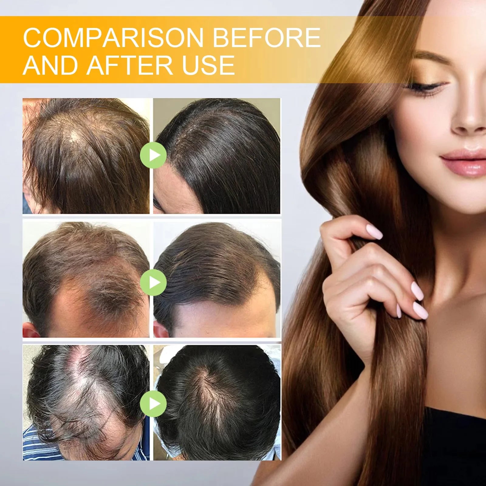 Biotin Hair Growth Serum Spray – Anti Hair Loss Treatment